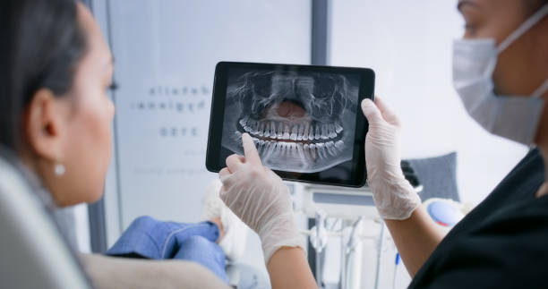 Licensed Tooth Extraction service in Santa Maria, CA - Smile Center Dentistry